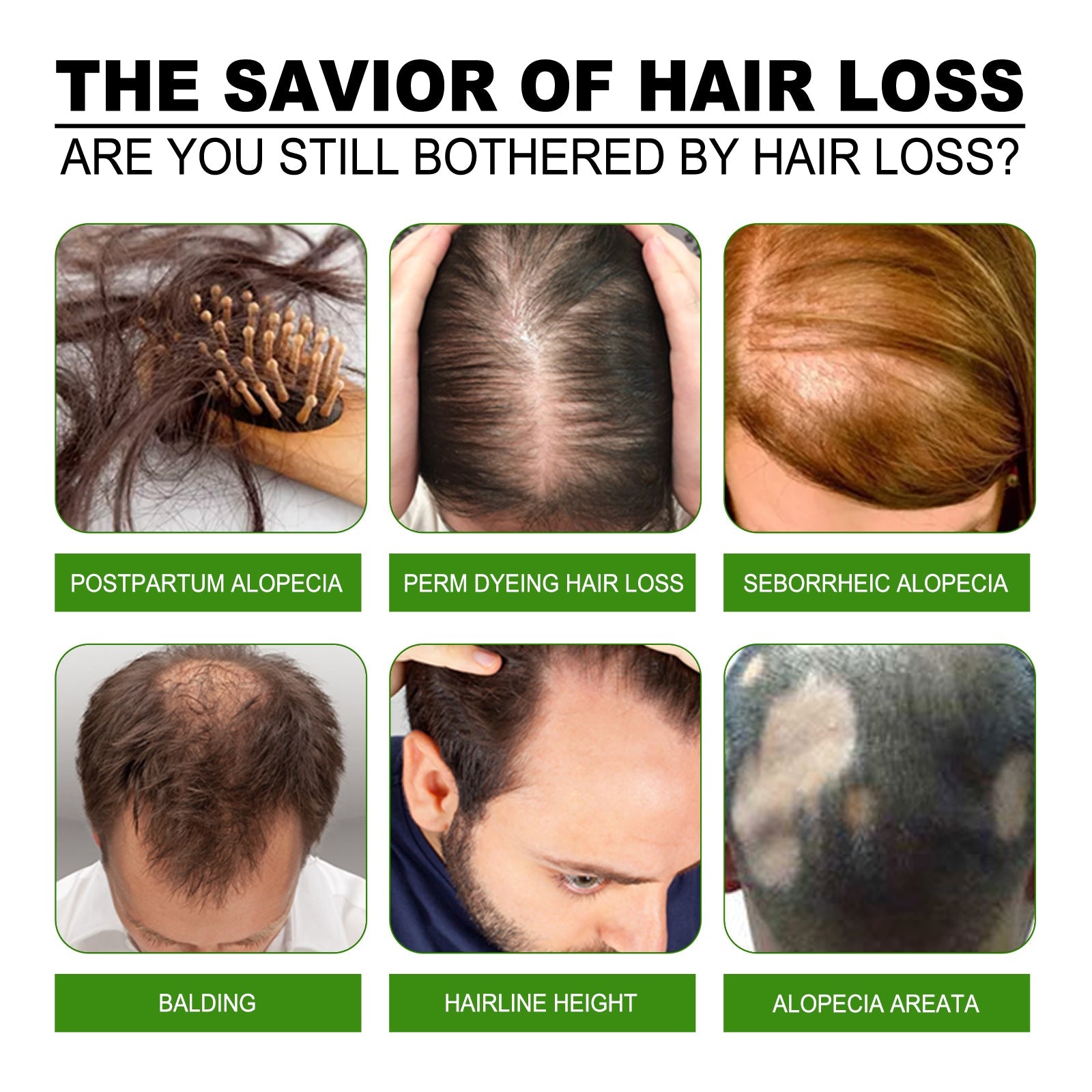 Hair Care Solution Gently Nourishes And Massages Scalp, Moisturizes And Softens Hair Care Spray