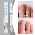 Nail Care Essence Pen, Fingernail Edge Soft Moisturizing Nail Surface Moisturizing And Nourishing Pen