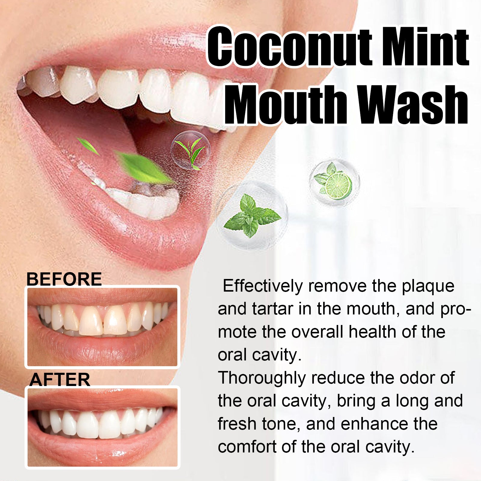 Teeth Rinse, Deep Clean Mouth Fresh, Deodorizing And Whitening Teeth Stain Removing Mouthwash