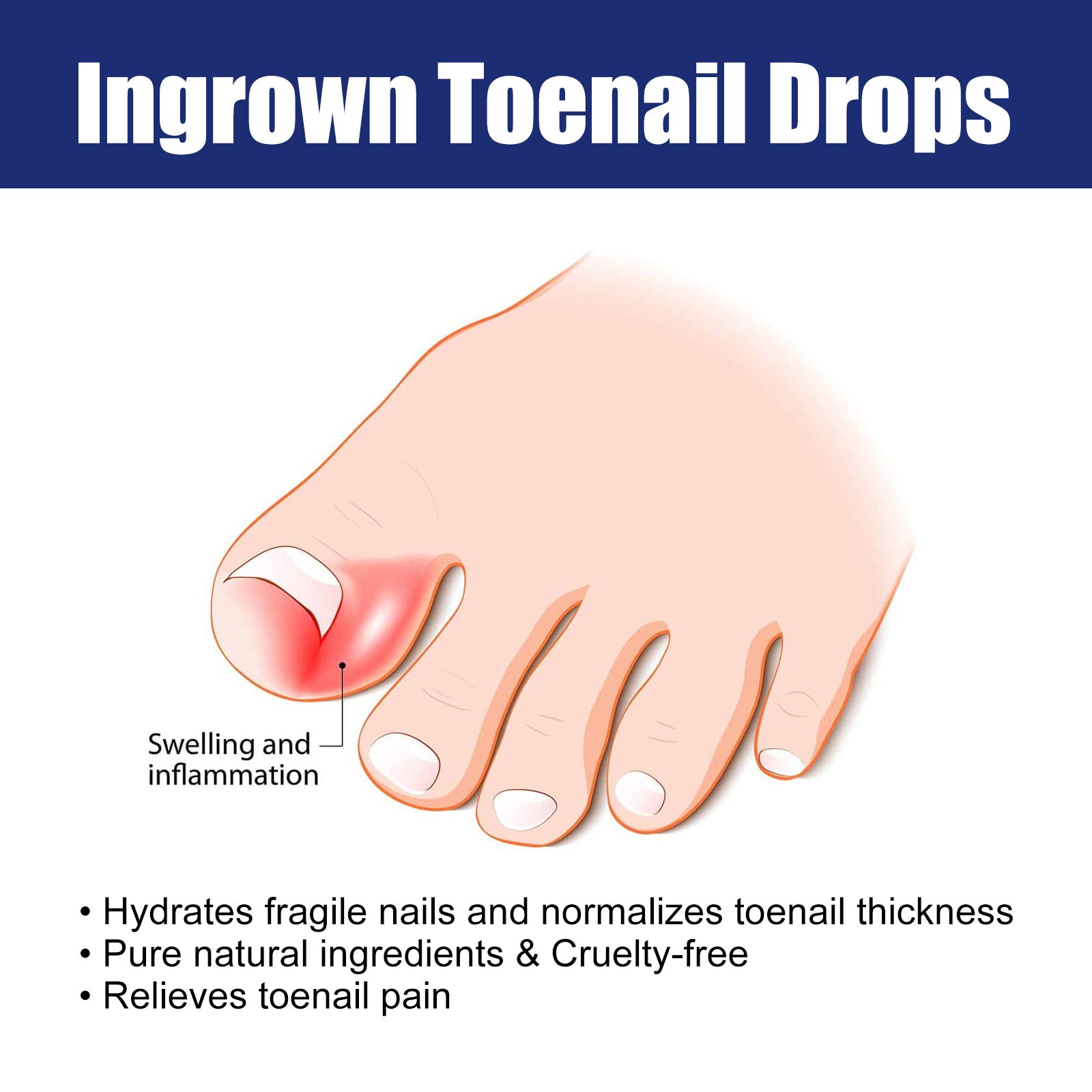 Nail Repair Solution Gentle Clean, Moisturize, Moisturize And Nourish Nails And Nails