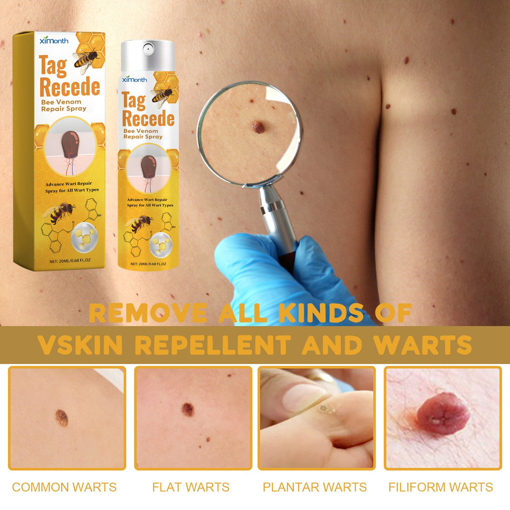 Bee Venom Wart Treatment Spray Improves Pimples, Moles, Repairs and Smooths Skin Wart Treatment Spray