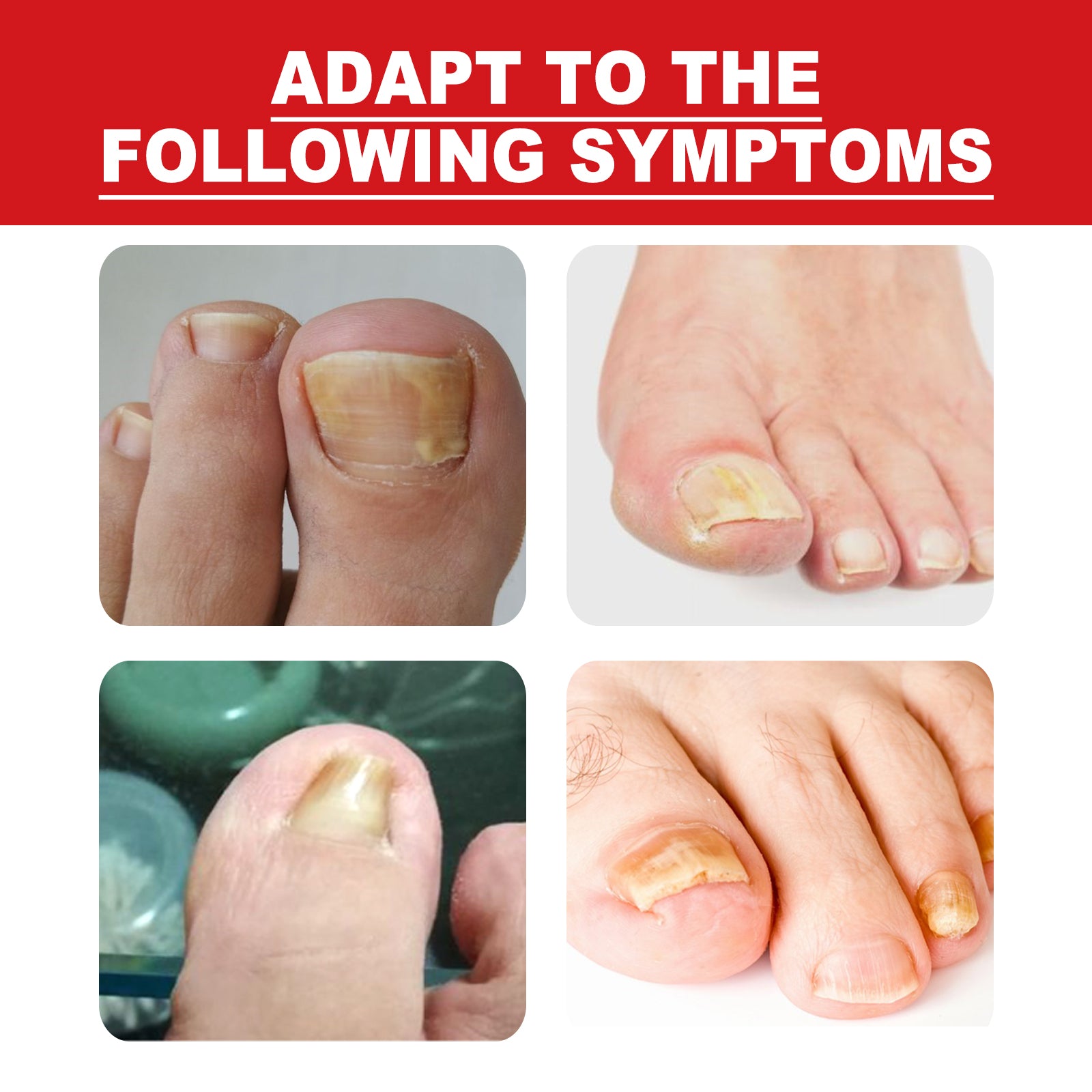 Toenail Repair Essence Moisturizes, Restores And Cleanses Foot Nails And Brightens With Essential Oil