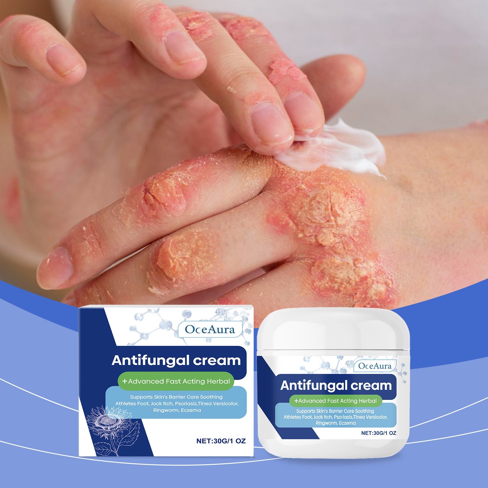 Skin Repair Cream Repair And Nourish Body Skin With A Gentle Formula For External Moisturizing Care Cream