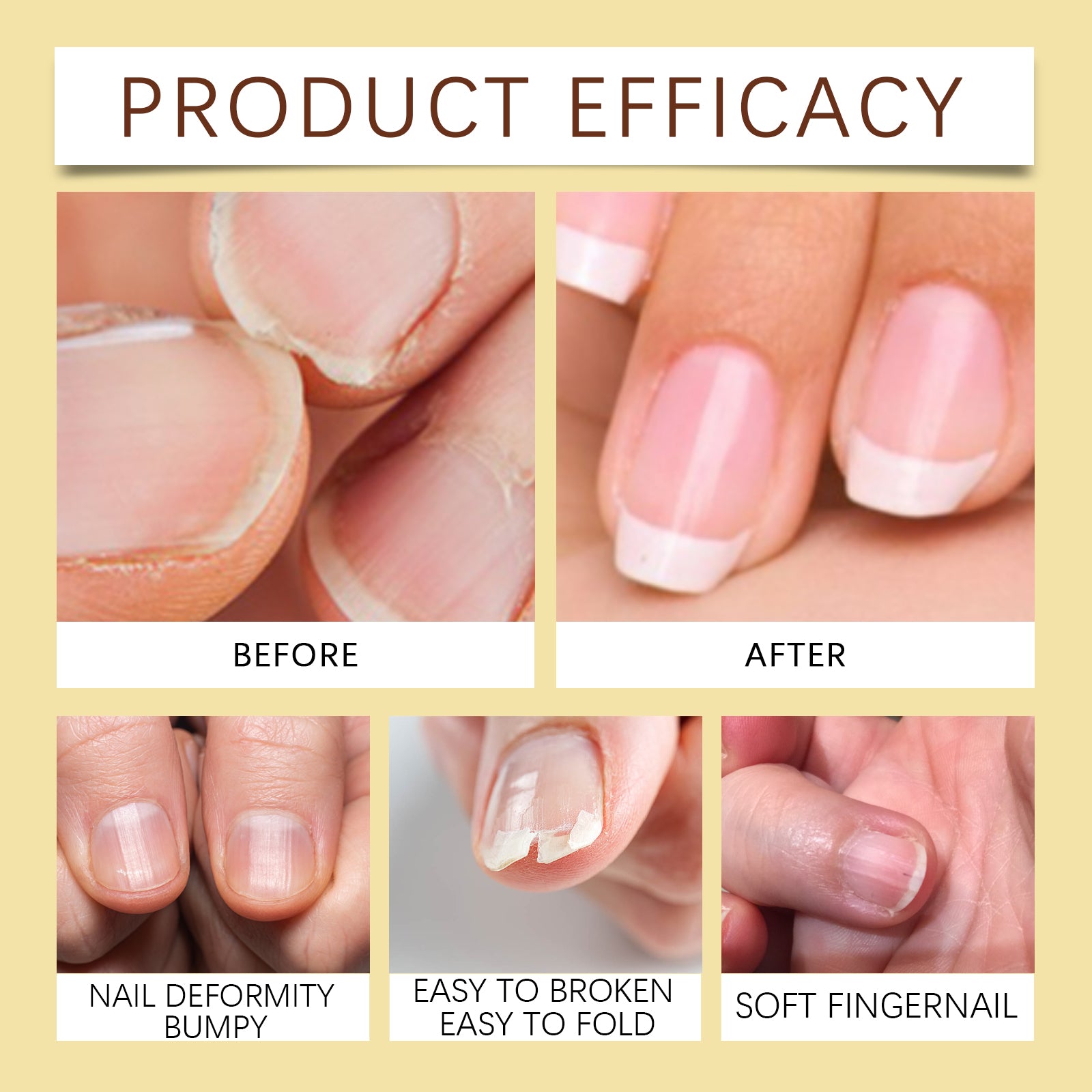 Jojoba Oil For Nails, Nail Care Anti-Barb Edge Oil Softening Nourishing Base Oil For Nail Protectors