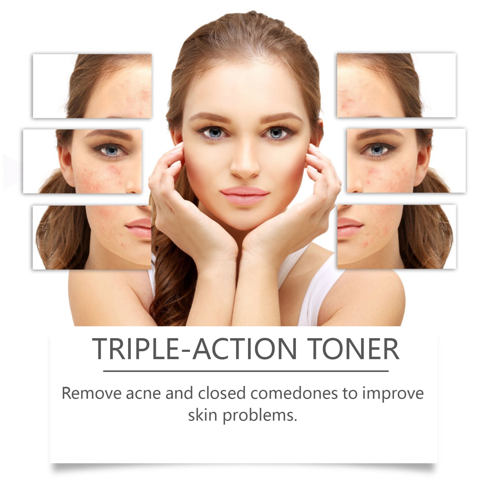 Facial Toner With Mild Ingredients To Lighten Acne, Nourish And Repair Facial Skin