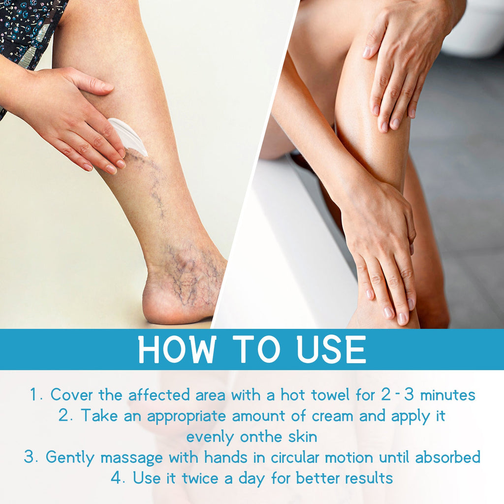 Varicose Spider Vein Repairing Cream, Relief Leg Pain Earthworm Leg Veins Care Massage Cream