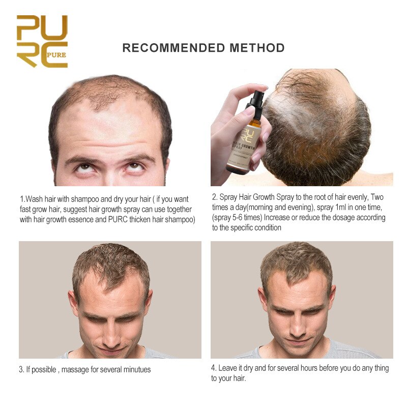 Purc 30ml Hair Growth Spray Natural Ginger Essence Spray Effective Extract Anti Hair Loss Nourish Root Hair Care Treatment