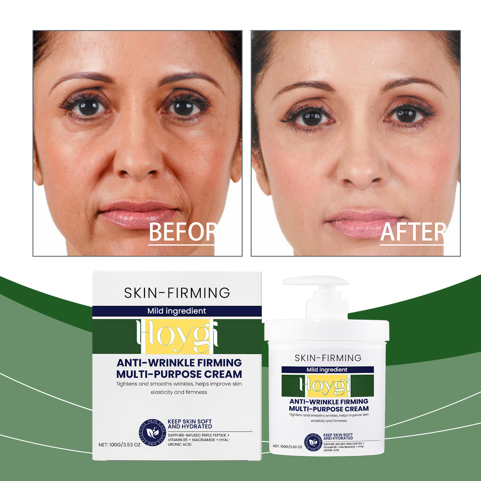 Moisturizing Cream Nourishes The Face, Hydrates The Skin, Moisturizes The Skin, And Moisturizes The Skin