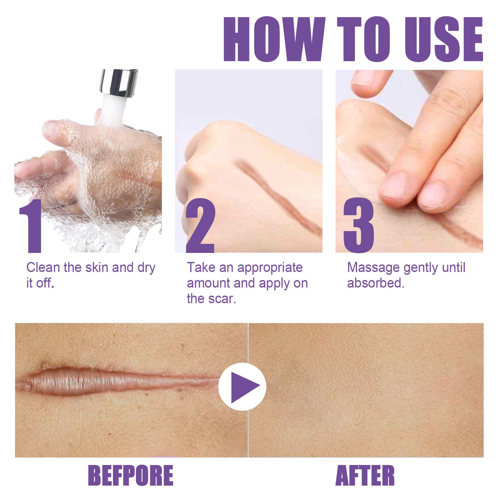 Skin Care Cream, Daily Moisturizing, Smoothing And Firming Skin Repair Postpartum Repair Topical Cream