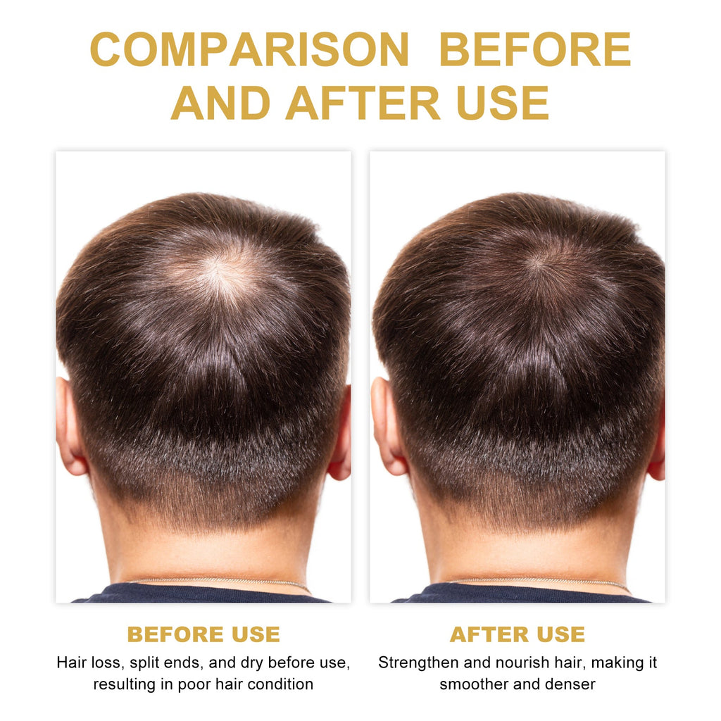 Hair Dense Oil, Scalp Cleaning Care Fluffy Soft Repair Dry Hair Impetuous Solid Hair Dense Hair Essential Oil