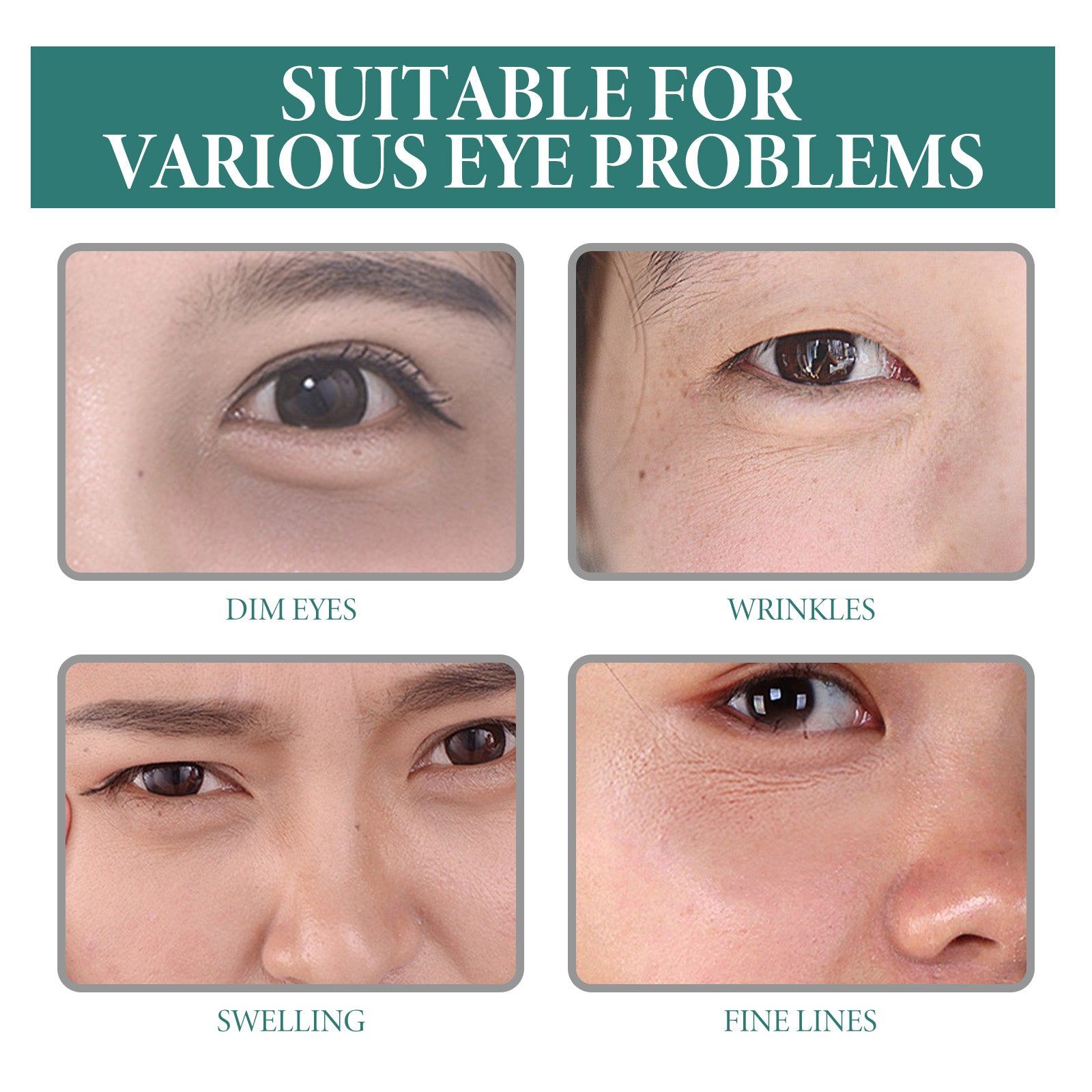 Puffy Eye Serum, Repair Essence Refreshing Hydrating Firming Brightens The Nicotinamide