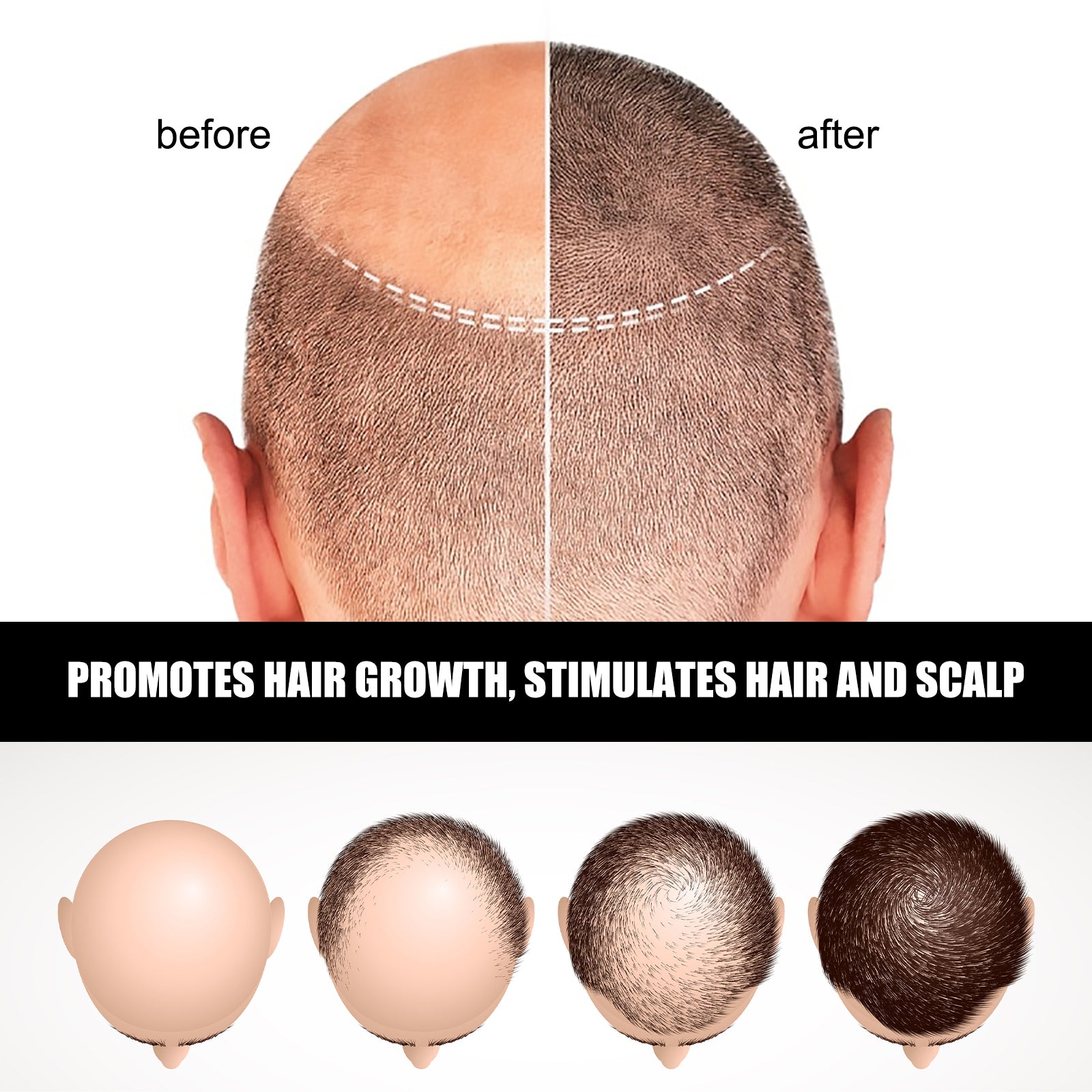 Hair Ampoule Serum For Dense, Volumizing, Moisturizing, Nourishing And Strengthening Hair