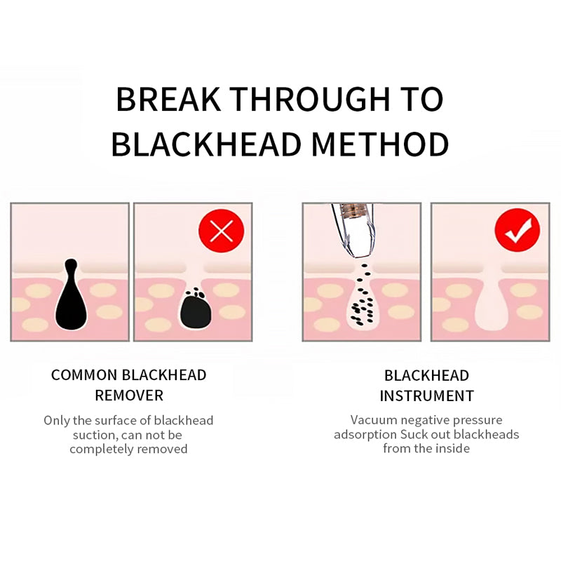 Blackhead Remover Face Deep Pore Cleaner Removal Vacuum Suction Facial SPA Diamond Beauty Care Tool Skin Care