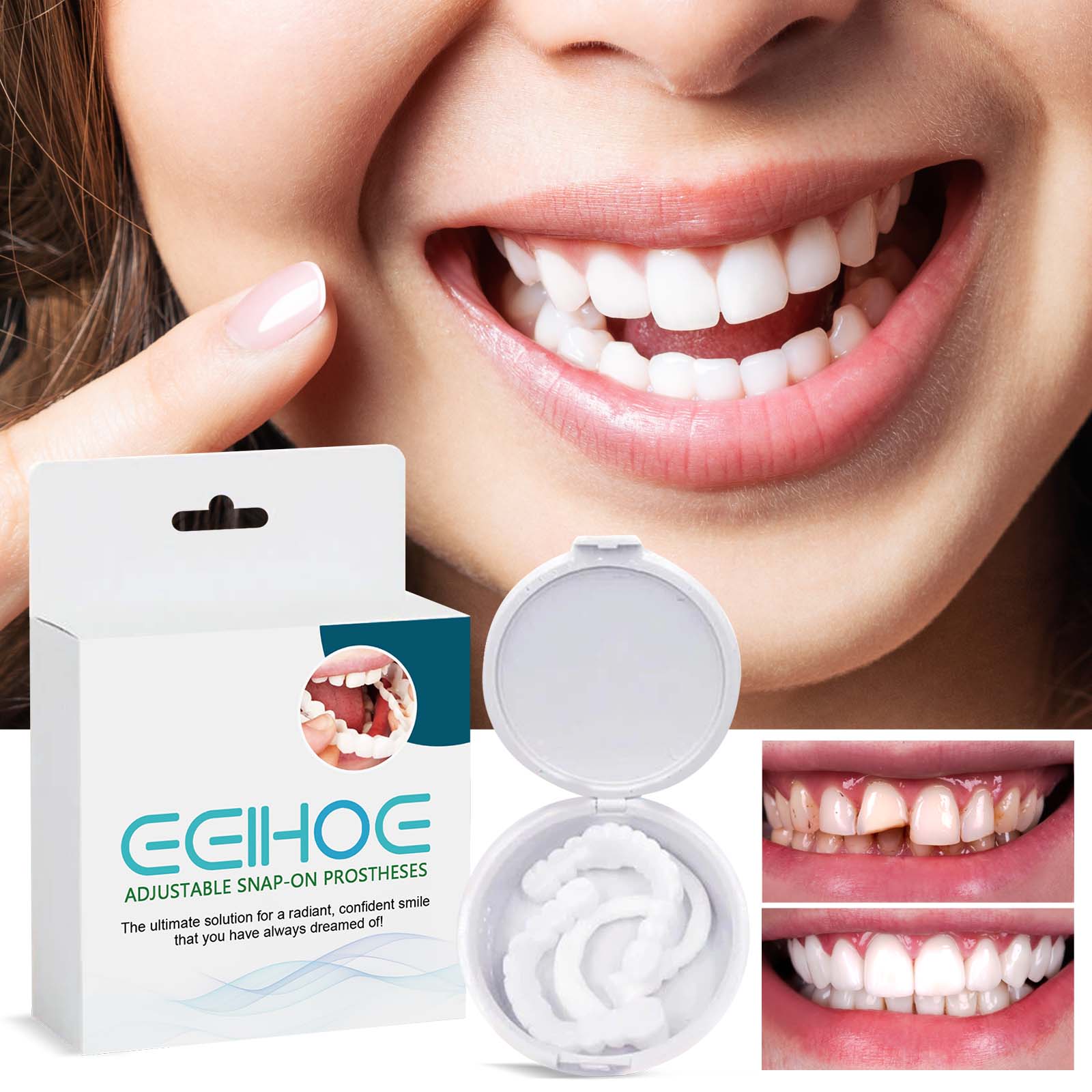 Adjustable Buckle Dentures, Modified Teeth Interdental Set Orthodontic Dentures Set